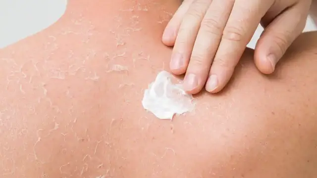 Cara Merawat Kulit Kering